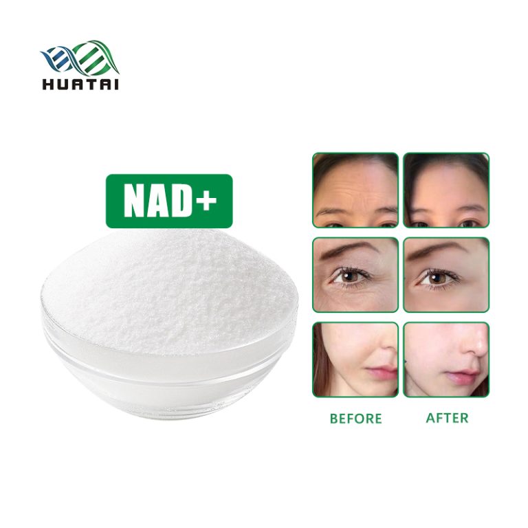 NAD