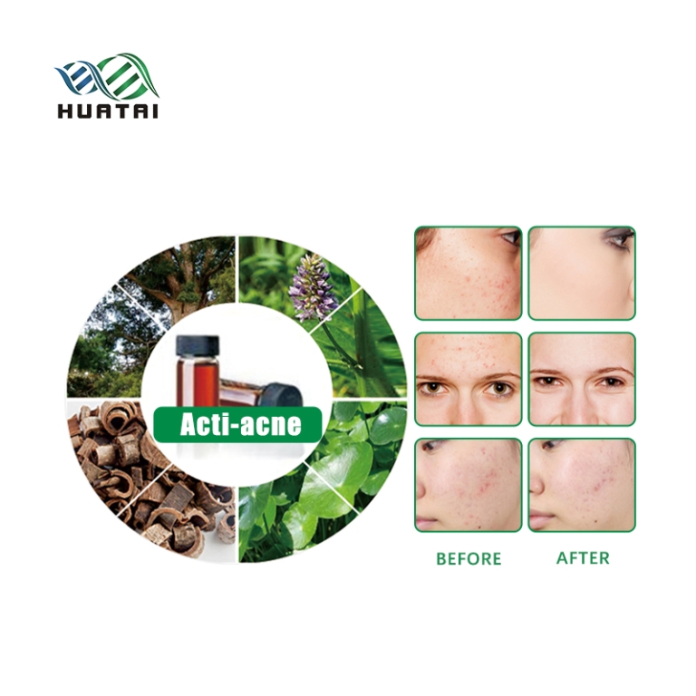 Agente composto anti-acne