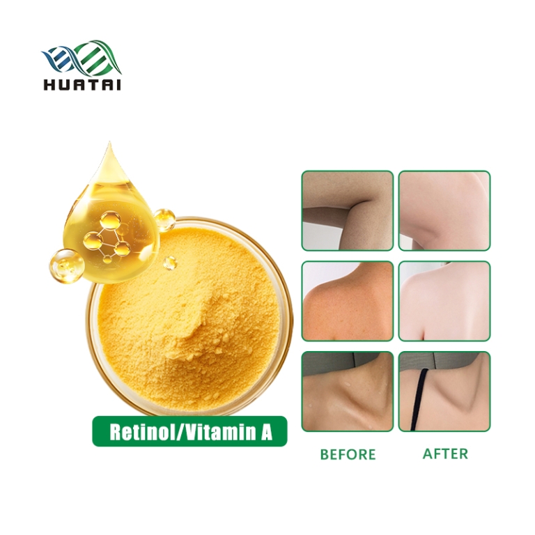 Retinol